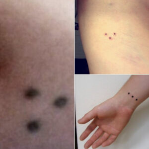 Red Dots on Your Skin…