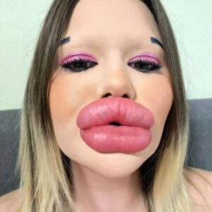 The individual boasting the largest lips on the planet!