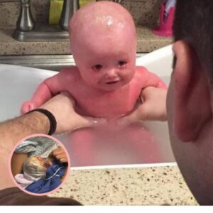 Emergency C-Section: Dad’s Shock as Baby’s Face Turns Unrecognizable, Room Goes Silent