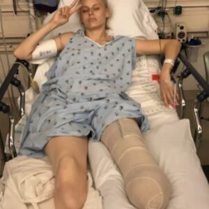 Her legs are amputated after using a common household product