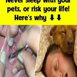 Don’t sleep with your pets, don’t risk your life, here’s why