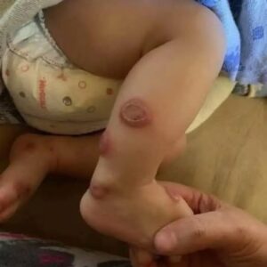 ALERT: These are the signs that it is cre…See more