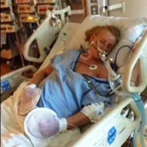 Her legs are amputated after using a common household product – Now she’s warning Her legs are amputated after using a common household product – Now she’s warning