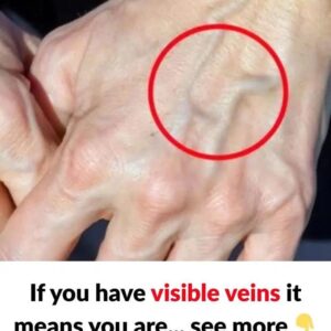 When to Worry About Veins That Appear Out of Nowhere When to Worry About Veins That Appear Out of Nowhere