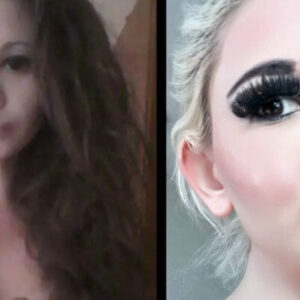 24-year-old woman wants the biggest lips in the world 24-year-old woman wants the biggest lips in the world