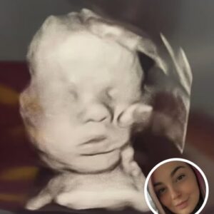 Pregnant Woman Hopes for a Healthy Baby, Amazed by Ultrasound Details