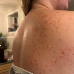 These are the consequences of sleeping with the…See more