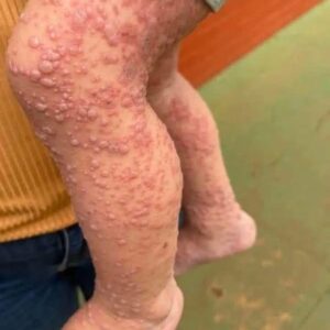 Unexplained Itching? What Your Body Is Trying to Tell You