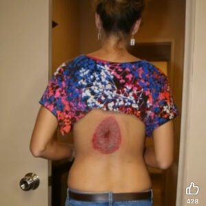 Skin Signals Used to Diagnose Serious Diseases