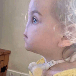 Tessa Evans’ Rare Condition: Overcoming Challenges