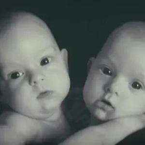 Conjoined Twins Bella And Abby Were Genuinely