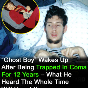 “Ghost Boy” woke up from coma after being trapped for 12 years