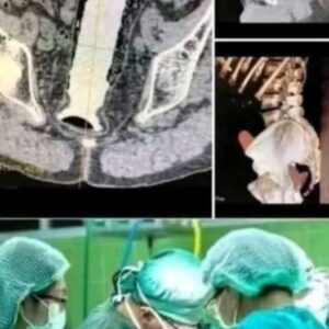 Girl had to be hospitalized for wanting to use a pe…See more