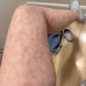 These are the consequences of sleeping with the… See more These are the consequences of sleeping with the… See more