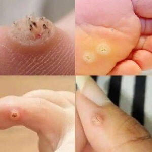 Be very careful if it comes out in your mouth, you are… Be very careful if it comes out in your mouth, you are…