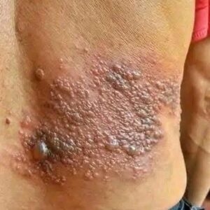 These are the consequences of sleeping with the…See more