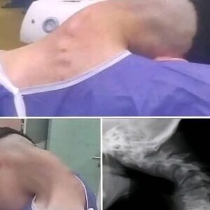 The Mystery of the Bent Neck: When a Young Man’s Posture Held a Secret The Mystery of the Bent Neck: When a Young Man’s Posture Held a Secret