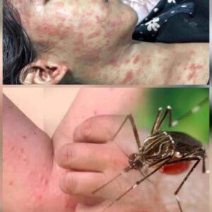 ALERT: New Disease Outbreak in China — Over 7,000 Cases Reported, Symptoms and Risks Revealed…see more ALERT: New Disease Outbreak in China — Over 7,000 Cases Reported, Symptoms and Risks Revealed…see more