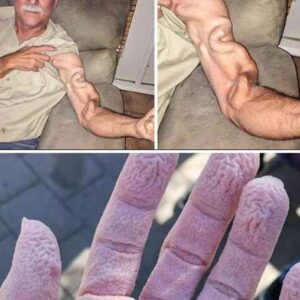 A man goes to stretch and ends up feeling a sharp pain in his arm, it was a ca…