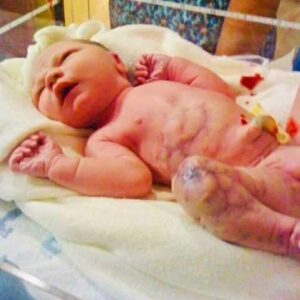 Mom delivers rainbow baby, only for dad to utter: ‘There’s something wrong’