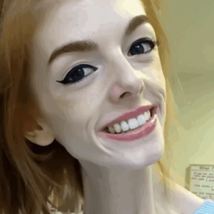 Inspiring Recovery: Annie Windley’s Journey from Anorexia to Health