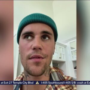 Justin Bieber reveals he received a positive test result for