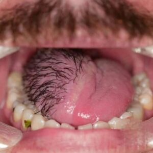 These are the consequences of sleeping with…See more