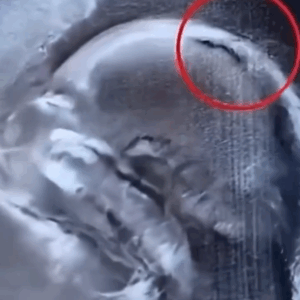 Doctors Stunned By What Appeared On The Ultrasound Screen