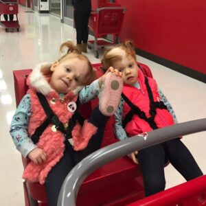 Siamese twin sisters were born with their h Siamese twin sisters were born with their h