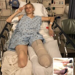 Woman Loses Her Legs Due To Common Household Product, Now She’s Warning Women Everywhere