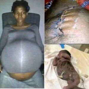 A 30-year-old woman in Georgia was declared brain dead A 30-year-old woman in Georgia was declared brain dead