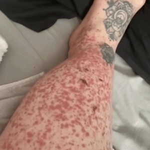 These are the consequences of sleeping with…See more