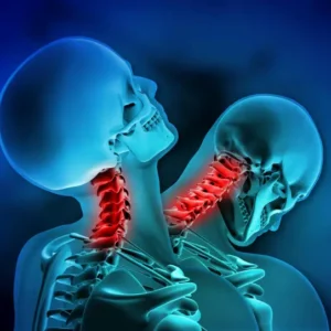 Neck Collapse Alert: Young Man Hospitalized with Dropped Head Syndrome Neck Collapse Alert: Young Man Hospitalized with Dropped Head Syndrome