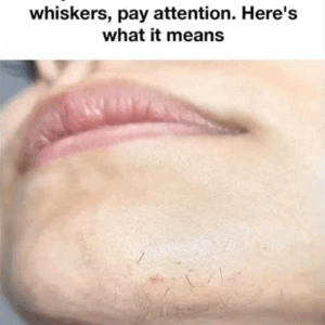 Exploring the Natural Causes of Chin Hair Growth Exploring the Natural Causes of Chin Hair Growth