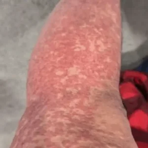 What Your Skin Could Be Telling You About Hidden Health Issues