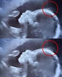 Doctors couldn’t believe what the