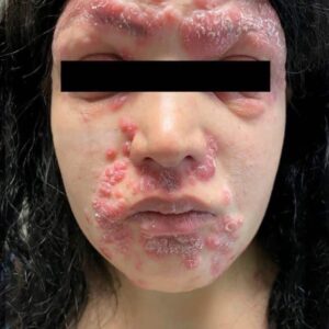 These are the consequences of sleeping co… See more in comment