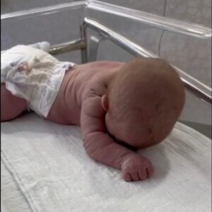 Baby born with an DIU peg… See more