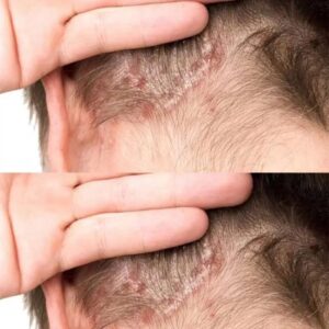 Found this on my son’s scalp. Have no idea what it is and we can’t get a doc appt soon. Tips?