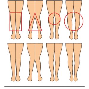 A WOMAN’S LEGS CAN TELL HOW HER IS