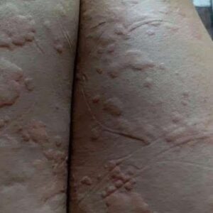 HT! These are the consequences of sleeping co! See more