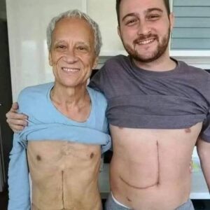Son who donated part of his liver to his father unfortunately ends up fa… See more