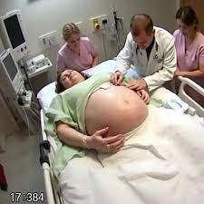 While tending to the bandages of a young woman in a coma for…