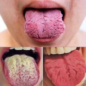 These Are the Consequences of Sleeping With the Signs Your Tongue Is Trying to Warn You About
