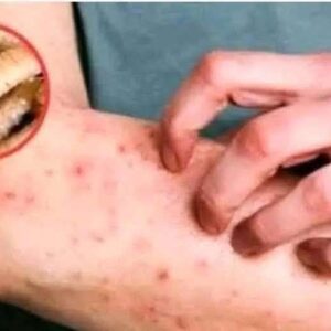 These Are The First Symptoms Of A…