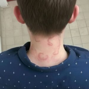 “My 8-Year-Old Has Been Experiencing This for Two Months — And It’s Getting Worse”