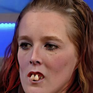 A few years ago, this woman became popular on social media because of her appearance . Due to the condition of her teeth, many criticized and mocked her . But it was precisely because of this that famous dentists noticed her and offered her a free procedure . Thanks to this, her smile and overall appearance changed dramatically, and now she looks much more beautiful . Are you curious to see how this girl looks today? If so, her photo after the changes is shown in the first comment