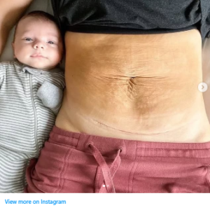 HealthMoms Get Brutally Honest About Post-Baby Bodies — And Fans Are Cheering