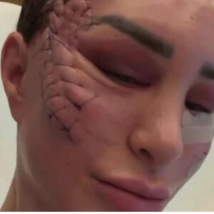 90 Day Fiancé Alum Shekinah Güven Sparks Massive Buzz With Candid Recovery Clip