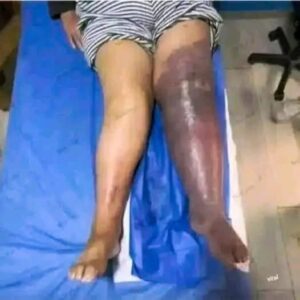 The Shocking Consequences of Sleeping With the…See more